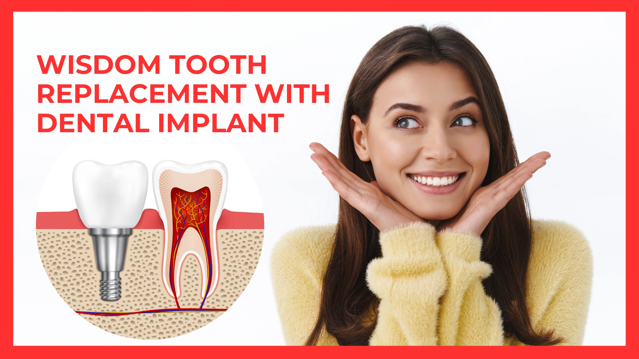 Wisdom tooth replacement with dental implant